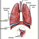 Illustration for article titled Info Penyakit Paru Paru Basah